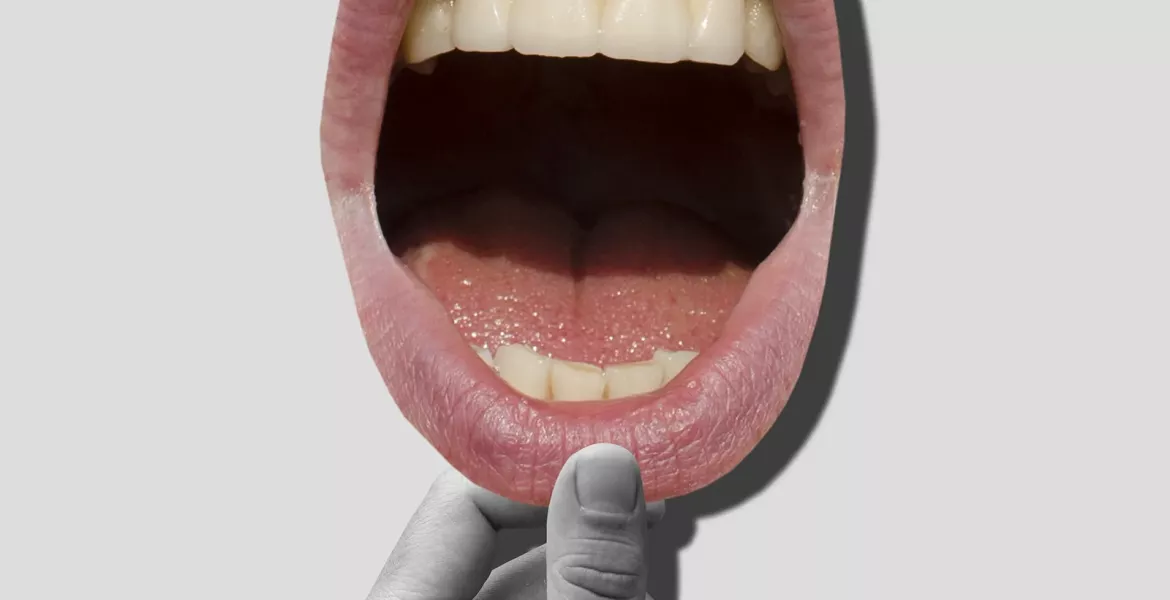 Illustration of a hand opening a mouth that's shouting.