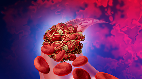 thrombosis medical illustration concept symbol as a group of human blood cells.